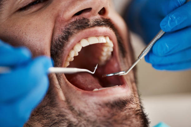 Best Cosmetic Emergency Dentistry in Erda, UT